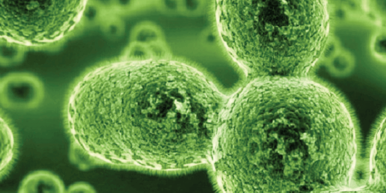 What Is Indoor Air Pollution? – Definition, Sources & Effects